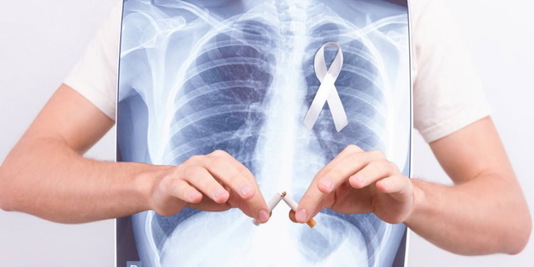 Desvelan los orígenes del cáncer de pulmón en personas que nunca han sido fumadoras