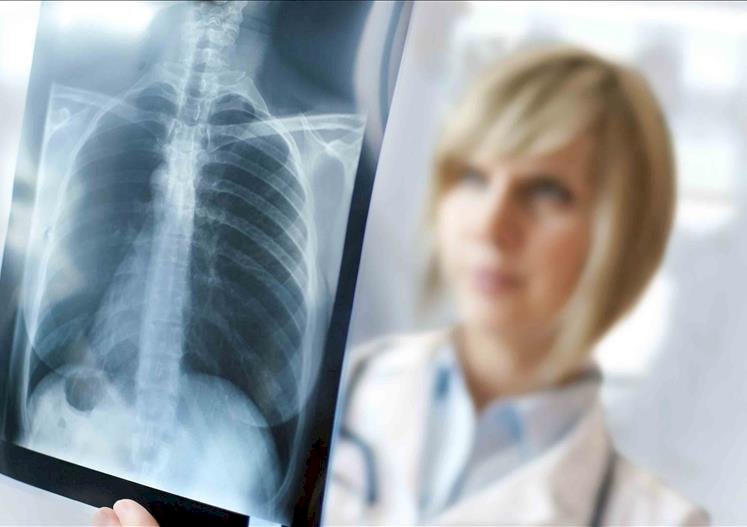 Estrategias para atacar el metabolismo del cáncer desde su base