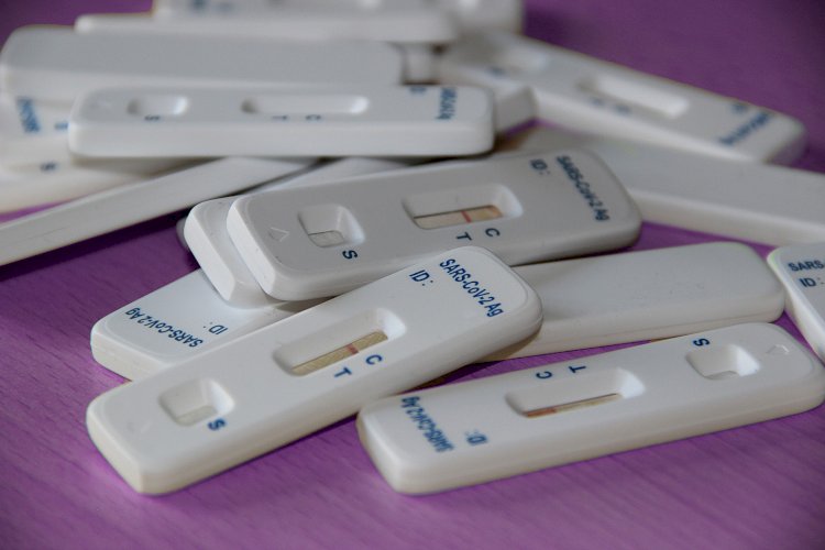 La Agencia del Medicamento pide la retirada de un test de antígenos