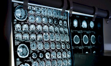 El Gobierno andaluz invierte más de 14 millones en mejorar infraestructuras de salud mental